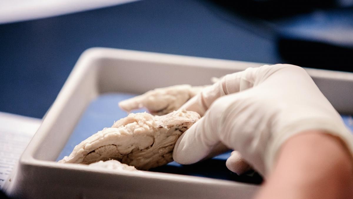 A hand holds a specimen 